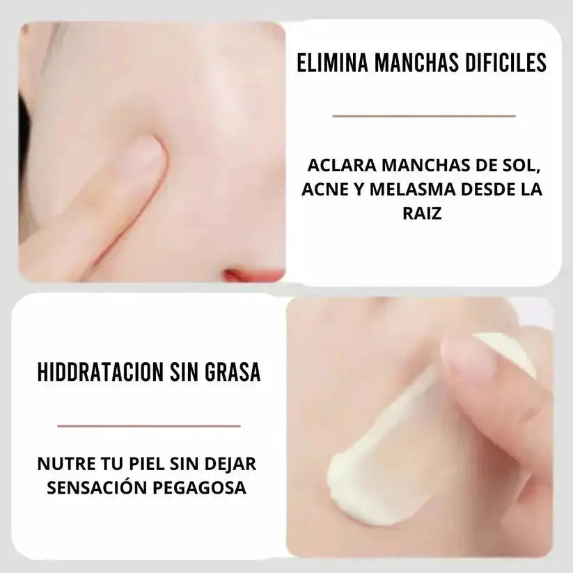 Arbutin White®  ✨ Crema Aclarante